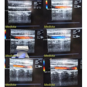 https://www.themedicka.com/10269-114103-thickbox/acuson-siemens-17l5-hd-10035724-linear-array-ultrasound-transducer-probe-24775.jpg