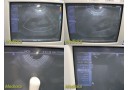 Siemens EC9-4 Endo-Cavity Ultrasound Probe W/ Case Holder & Endo Insert ~ 25517