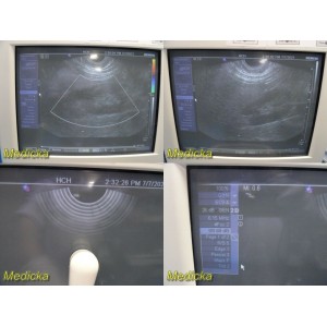 https://www.themedicka.com/10513-116928-thickbox/siemens-ec9-4-endo-cavity-ultrasound-probe-w-case-holder-endo-insert-25517.jpg