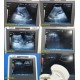 Philips HD3(HD3-Exp) Ultrasound System W/ C7-3 Convex Probe, Printer & PSU~25452