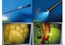 ACMI Circon GYRUS LAP 10-0 FA Rigid Telescope 10mmx0° Laparoscope *TESTED*~25294