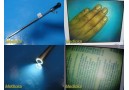 Conmed Linvatec 1000E Rigid Telescope 10mmx0° Laparoscope, Autoclavable ~ 25295