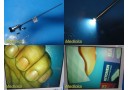 Perzio Health SCHÖLLY 11.0055a 0° x 5mm HD Scope Rigid Telescope ~ 25297