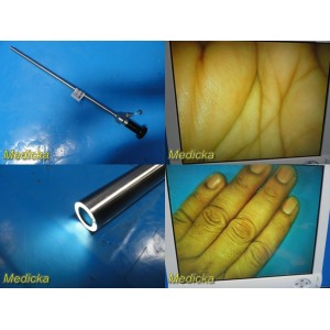 https://www.themedicka.com/10786-120063-thickbox/gyrus-acmi-circon-lap-10-0-fda-0-x-10mm-rigid-telescope-laparoscope-25298.jpg