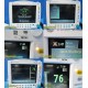 GE Datex Ohmeda S/5 FM Patient Monitor W/ E-PSMP Module & NBP / ECG Leads ~25171