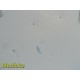 Gynecare 2100 VersaPoint ESU W/ Foot Control *TESTED & WORKING* ~ 25953