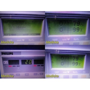 https://www.themedicka.com/11088-123513-thickbox/philips-m1360b-series-50xm-fetal-maternal-monitor-only-no-accessories-25941.jpg