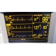 Datascope Passport XG Bedside Monitor W/ Leads (NBP EKG SpO2 & T/ Print ) ~12140