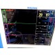 PACE TECH Vitalmax 4000 Color Monitor W/ New SpO2 EKG NBP Leads & Adapter ~12312