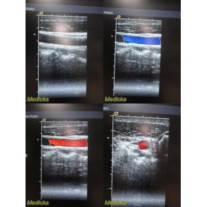 https://www.themedicka.com/11712-130569-thickbox/siemens-medical-acuson-6l3-08241112-linear-array-ultrasound-probe-25709.jpg