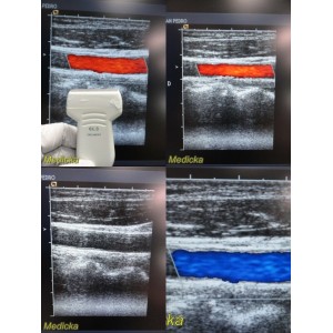 https://www.themedicka.com/11933-133040-thickbox/2008-siemens-medical-acuson-6l3-linear-array-ultrasound-probe-p-n-0825259825705.jpg