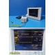 Datascope Passport XG Multi-Parameter Patient Monitor W/ Patient Leads ~ 26897