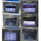 Philips M3002A Intellivue X2 Patient Monitor W/ Modules & Module Rack ~ 27567