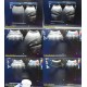 Philips C9-4 Convex Array Ultrasound Transducer Probe P/N 453561212363 ~ 27477