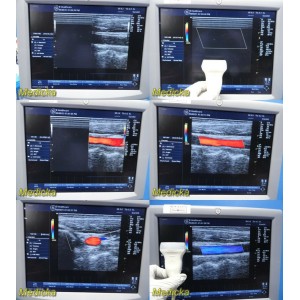 https://www.themedicka.com/13047-146015-thickbox/2009-ge-9l-linear-array-ultrasound-transducer-probe-ref-5131433-tested-25350.jpg