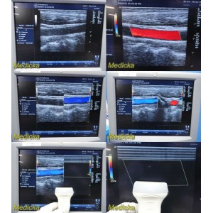 https://www.themedicka.com/13048-146027-thickbox/2014-ge-5131433-9l-linear-array-ultrasound-transducer-excellent-bflow-25348.jpg