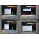 2008 Philips Intellivue MP20 Ref M8001A Monitor W/ M3001A Module & Leads ~ 28052
