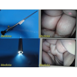 https://www.themedicka.com/13842-155040-thickbox/smith-nephew-dyonics-8000-rigid-telescope-laparoscope-0x10mm-28214.jpg