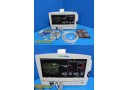 WA Protocol Inc 62000 Series Patient Monitor W/ ECG, SpO2 & NBP Leads ~ 28412