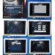 2006 Philips IU22 Diagnostic Ultrasound System P/N 8500-0064 W/O Probes ~ 28402