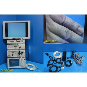 https://www.themedicka.com/14263-159881-thickbox/stryker-1088-endoscopy-sys-w-camera-headcculight-sourceims-monitor-21686.jpg