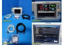 2014 Philips 863073 Sure Signs VS3 Multi-Parameter Monitor W/ Leads~28863