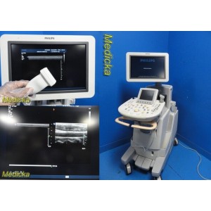 https://www.themedicka.com/14486-162464-thickbox/philips-iu22-ultrasound-system-w-l12-5-probe-msk-breastthyroid-sm-parts28996.jpg