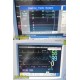Philips M8001A Intellivue MP20 Monitor W/ M3001A MMS Module & Leads ~ 29404