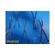 6X Codman Classic 37-1521 Masterson Hysterectomy Forceps ~ 23978