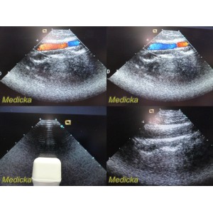 https://www.themedicka.com/14908-167326-thickbox/acuson-8v5-sector-array-ultrasound-transducer-probe-23962.jpg