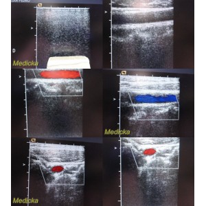 https://www.themedicka.com/14911-167362-thickbox/2006-acuson-6l3-linear-array-ultrasound-transducer-probe-23957.jpg