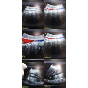 https://www.themedicka.com/14912-167374-thickbox/2003-acuson-6c2-convex-array-ultrasound-transducer-probe-model-08248186-23955.jpg