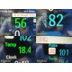 Philips Intellivue Neonatal MP70 Monitor Ref M8007A W/ M3001A Module,Leads~29706