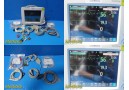 2011 Philips 86135 Intellivue MP30 Monitor W/ MMS Module & Patient Leads ~ 29719