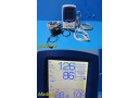  W. Allyn 45NT0 LXI Spot Vitals Monitor, Nellcor SpO2 W/ Patient Leads ~ 29744