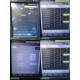 Mindray Datascope 6103F-PA00047 Accutorr 7 Vitals Monitor W/ Patient Leads~30534