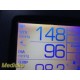 2012 Welch Allyn 45NT0 Spot Vital Signs LXI Monitor W/ Leads & NEW BATTERY~30597