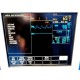 GE SOLAR 8000 Monitor W - Chromamxx 17" LCD, Printer, Rack Modules & Leads  12330