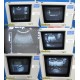 Shimadzu SDU-350A Portable U.S W/ Ergo Cart VA57R-03745U/TV11R-055U Probes~22981