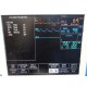 GE SOLAR 8000 Monitor W - Chromamxx 17" LCD, Rack, Modules, Leads & Printer 12331