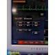 2014 Fukuda Denshi DS7200 Touchscreen Patient Monitor W/ Patient Leads ~ 30749