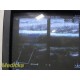 Philips L15-7io Broadband Compact Linear array Transducer PROBE ~ 30417