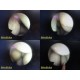 Olympus LF-DP Flexible Tracheal Intubation Fiber Scope W/ WA0331A Guide ~ 30434