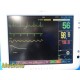 Fukuda Denshi DS-7210 Dynascope Patient Monitor W/ New-Non-OEM Leads ~ 31007