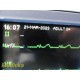 GE Dash 4000 Patient Monitor, Standard Leads, Printer, Ohmeda SpO2, 2X IBP~30999