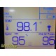 2013 Welch Allyn Hillrom 45NTO Spot Vital Signs LXI Monitor W/ PSU Leads ~ 30989
