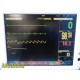 Fukuda Denshi DS-7200 Patient Monitor, NEW LEADS (ECG,NBP,SpO2,Temp,IBP) ~ 31093