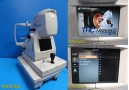 Topcon TRC-NW300 Non-Mydriatic Retinal Camera ~ 31121