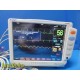 Fukuda Denshi DS-7000 (ECG,3X IBP,NBP,2X TEMP,PRINT,GAS) Monitor W/ Leads ~31511