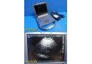 Sonosite P07071-18 Micromaxx Ultrasound Console W/ PSU, Battery(FOR PARTS)~31542